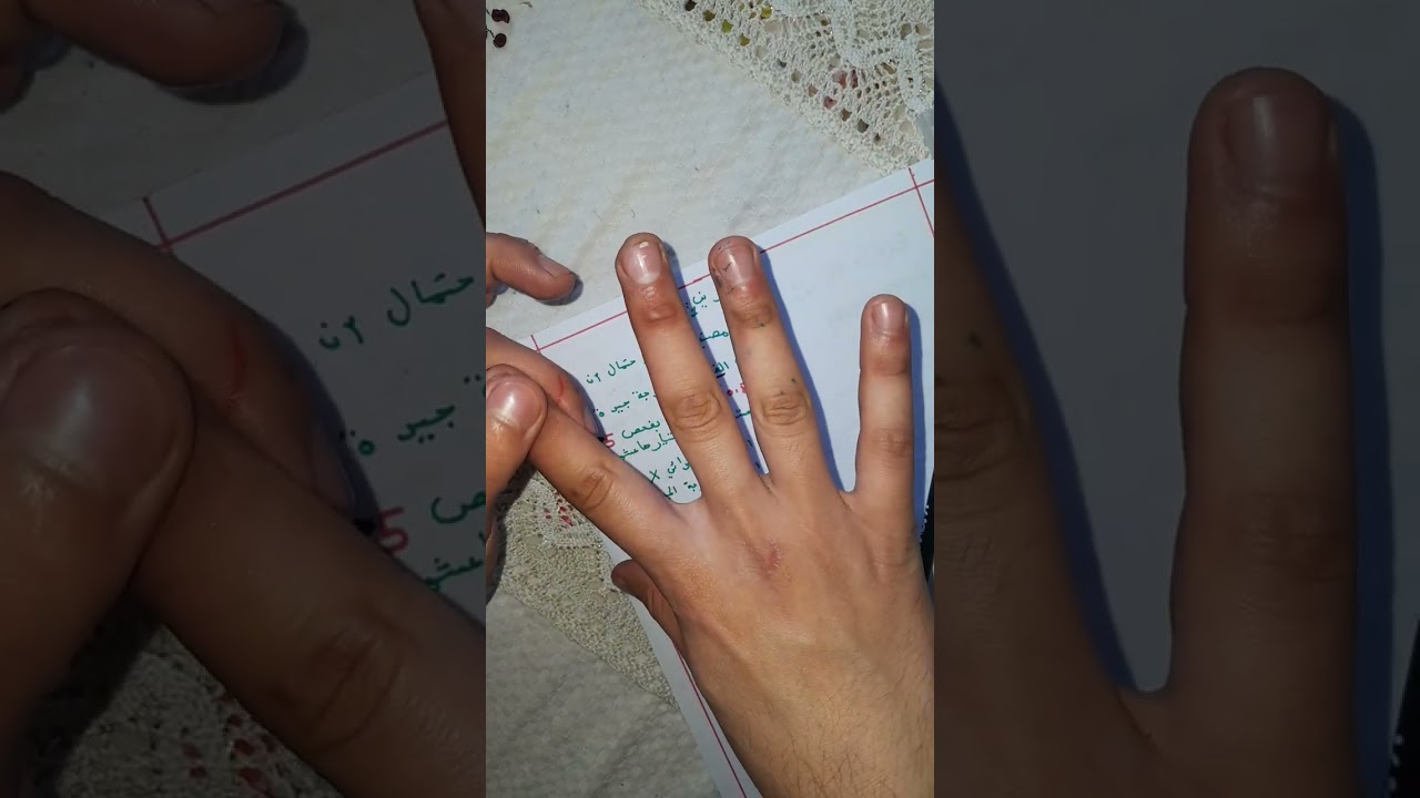 توزيع بينوميال إحصاء 3 شرح مبسط + تمرين (مثال)  للجامعيين 