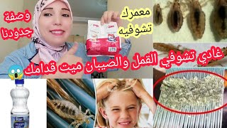 شاهدي?أقوى وأسهل علاج طبيعي للقمل وبيضه في ساعة فقط/أقسم بالله سيختفي للأبد بدون رجعة⛔ب 3 مكونات فقط