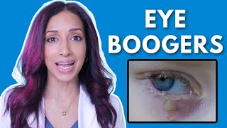 Is Morning Eye Discharge Normal? Eye Doctor Explains