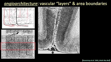 ISMRM MR Academy - High Resolution Applications: Cortical Layers