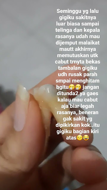 cabut gigi berlubang