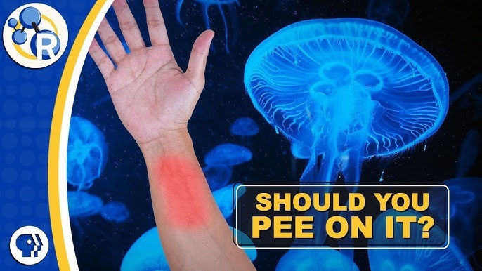Can Jellyfish Sting Each Other
