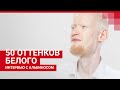 История спортсмена-альбиноса | 72.RU