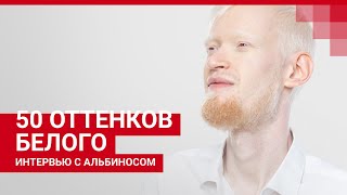 История спортсмена-альбиноса | 72.RU