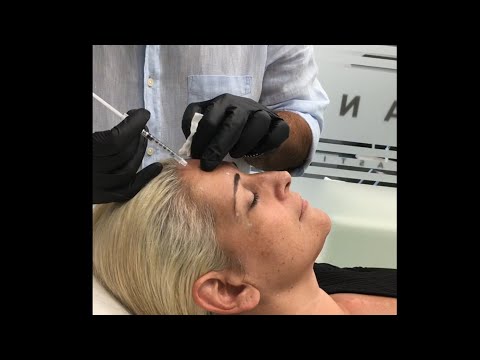 Botox: για τις ρυτίδες έκφρασης στο πρόσωπο