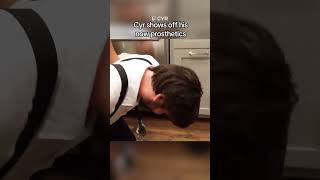 Cyr shows off his NEW prosthetic arms