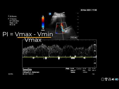 How to... Obtain a Portal Vein Waveform