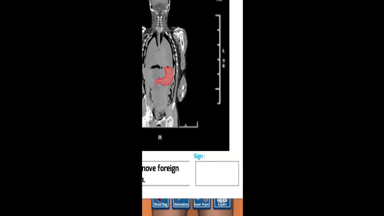 Surgery Master 3D Gameplay_Human body Surgery_3D Android Games 2023 2024