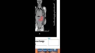 Surgery Master 3D Gameplay_Human body Surgery_3D Android Games 2023 2024 screenshot 4