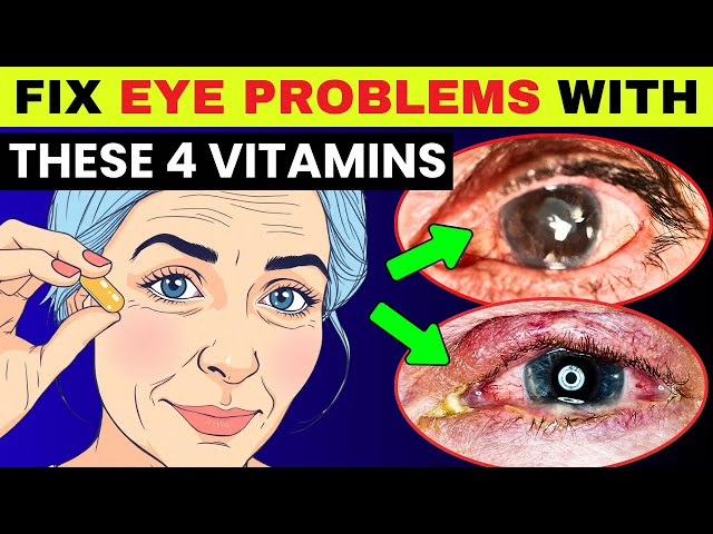 Top 4 Vitamins to Fix Eye PROBLEMS Fast! | Protect Your Eyes
