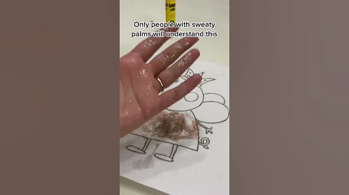 Life with sweaty palms #excessivesweating #hyperhidrosis #sweatypalms