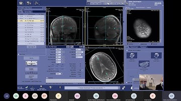 Demo on Optimizing Productivity with HyperSpeed Neuro Protocols on SIGNA™ Pioneer