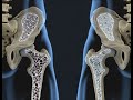 Margarita Naturalmente con el tema: &quot;Osteoporosis, otra perspectiva&quot;.