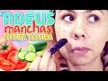 Como Tirar Manchas De Espinhas Usando Ingredientes Que Você Tem Em Casa | Receita Caseira