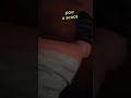 I unlocked knee pads at lvl 10yr old#kneepads #scooter #reveal #leg #bruises #cuts #scars
