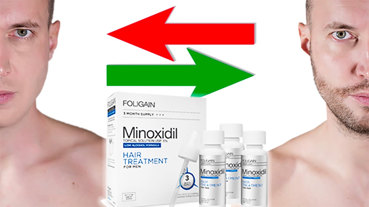 Kirkland Minoxidil Beard Review + Before and after + Side Effects & to Use it