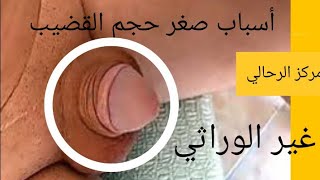 عندك القضيب صغير وعمرك كبير هذا المشكل له علاج خاص وناجح بإذن الله 0660301850