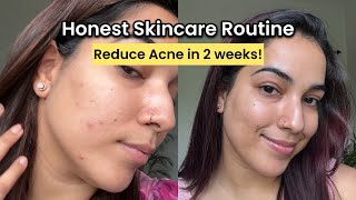 How to reduce acne in just 2 weeks? Honest Morning Skincare Routine!  #acne #skincare #acnetreatment