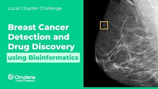 BioInformatics on Breast Cancer Treatment using Machine Learning