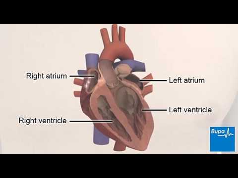 Video: Heart Block (Hoàn Thành) Trong Dogs