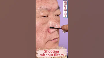The BEST Blackhead Nose Strip I Have Ever Seen Blackhead Blackheads Blackheadsremoval Largepores 