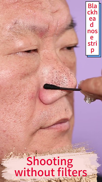 The BEST blackhead nose strip I have ever seen! #blackhead#blackheads#blackheadsremoval#largepores