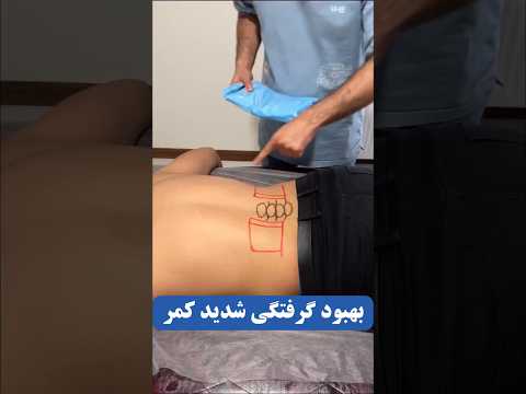 درمان کمر درد شدید رگ به رگ شدن دیسک کمر تنگی کانال نخاعی ماساژ کمر کمر درد زانیار صالحی سرد و گرم
