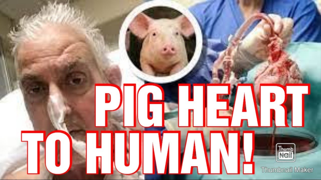 Breakthrough surgery US surgeons Implanted a pig heart in Human