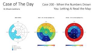 Case of the Day - 200 -  When the Numbers Drown You - Letting AI Read the Map