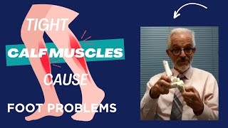 Tight Calf Muscles Lead to Foot Problems