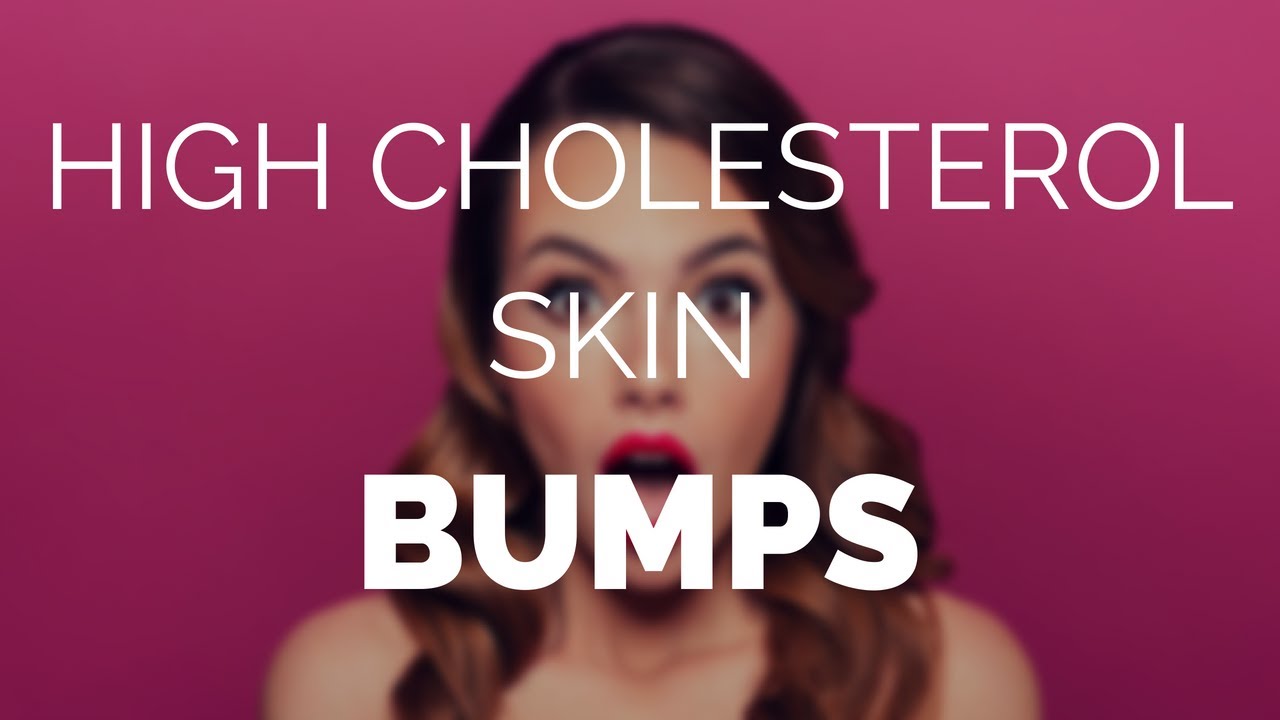 High Cholesterol Bumps On Face