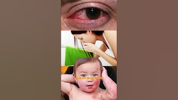 Formaldehyde sát thủ thầm lặng ở gia đình #kientrucsu #interiordesign #thietkenoithat #kiemchacsu