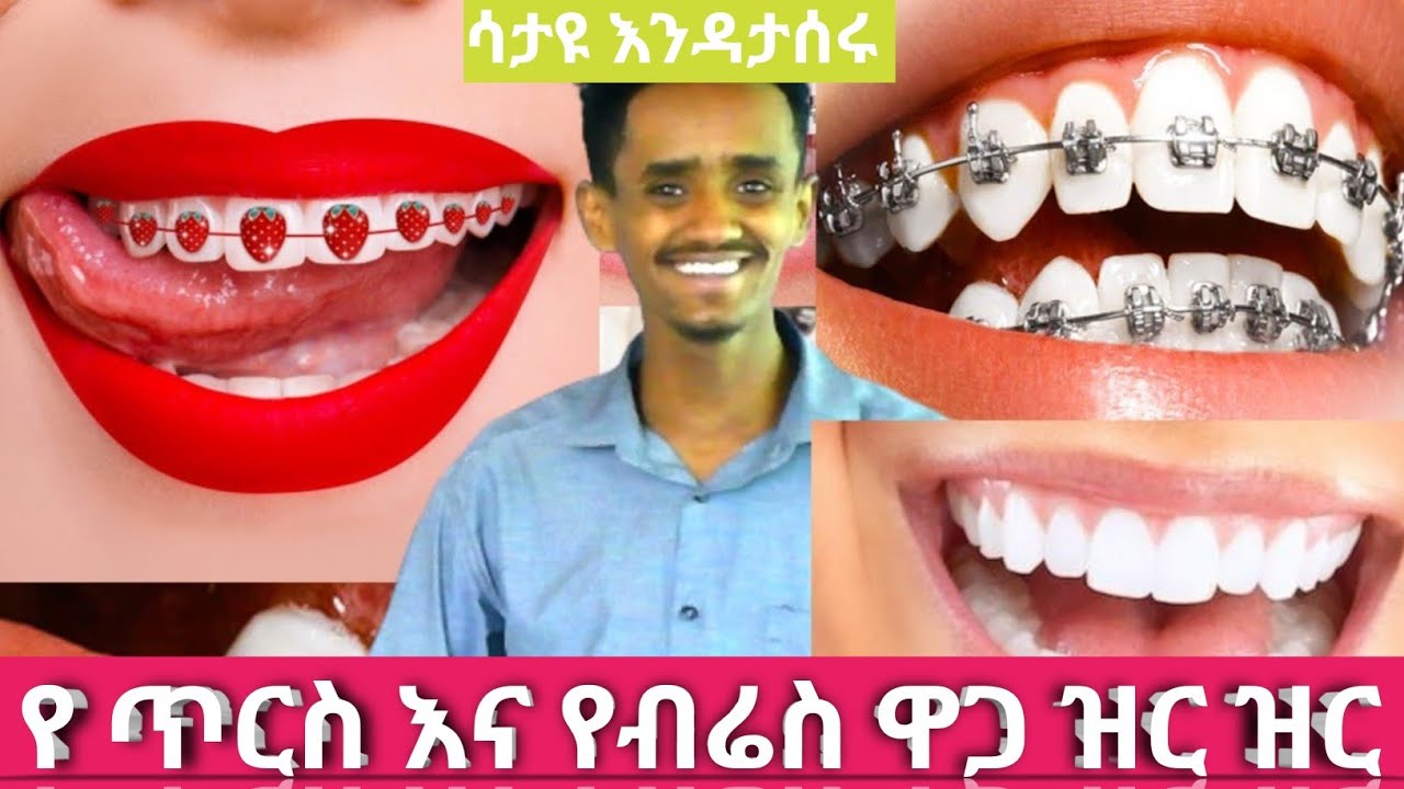 How Much Do Braces Cost In Ethiopia