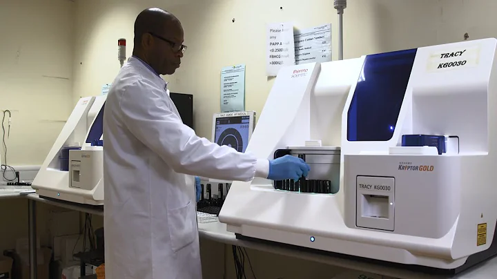 Thermo Scientific™ B·R·A·H·M·S KRYPTOR GOLD – the advantages of B·R·A·H·M·S KRYPTOR GOLD and TRACE t