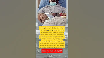أعلنت وفا ته رسمي ا ثم صر من على طاولة المشرحة هذه كانت الحكاية اكسبلور Viral علم النفس 