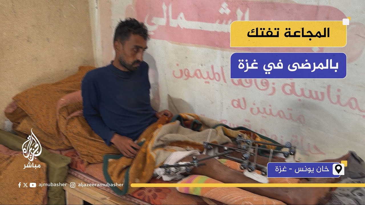 77 يوما من الحرب والحصار.. المجاعة تفتك بالمرضى في غوى