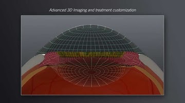 Femtosecond Laser Video