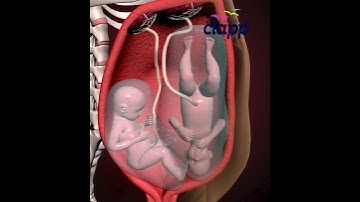 Twins fight for supremacy inside the womb ( 3D Animation )