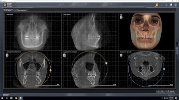 Galileos Ceph from Sidexis to CephX.com