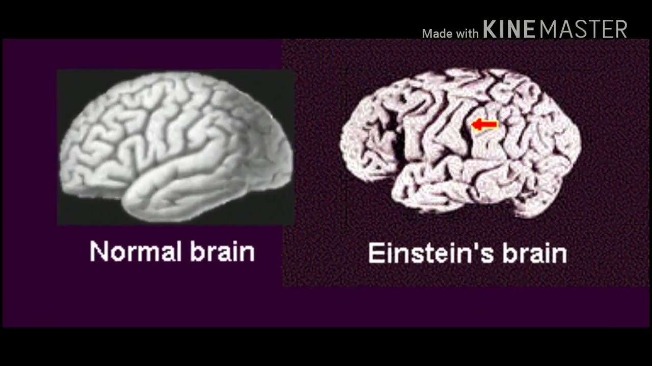 Гениальные мозги. Мозг гения и мозг обычного человека. Мозг Эйнштейна и обычного человека.