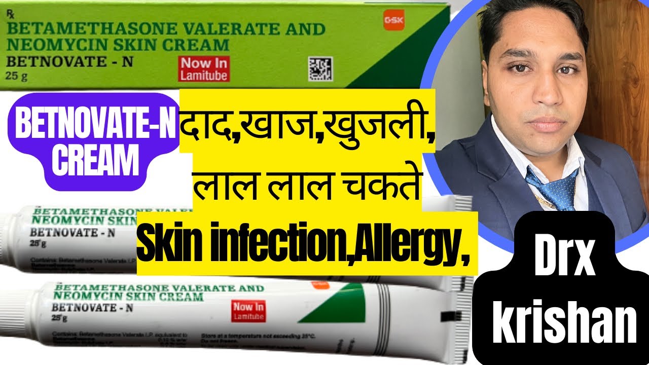 betnovate n betnovate n skin cream betnovate n cream betnovate n