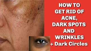 Skincare Routine | Clear Dark Spots And Dark Circles on Face And Neck + Anti-Aging