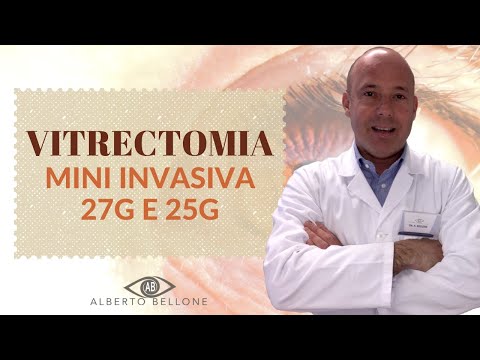 Vitrectomia Mini Invasiva 27G e 25G - Indicazioni e Vantaggi - Dr Bellone