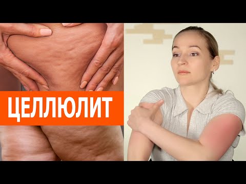 Лучшие приёмы против целлюлита. Убрать дряблость рук дома. Делаем точеные ручки