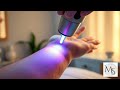 Best Age to Start Laser Hair Removal – What You Should Know | Pembroke Pines