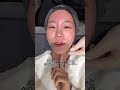 韓国美容うけてきた！