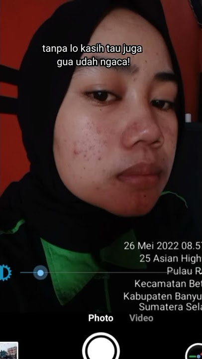 #jerawat