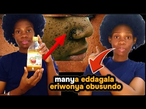 Obusundo Goba Obusundo Nga Okozesa Eddagala Lino Munaku 7 Zokka Ojakulaba Nga Ensundo Zigenda