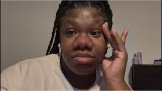 I Reached Out To My Bd Child Support Who Will Be In The Room With Me During Birth