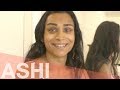 FFS Surgery Patient Testimonial - Ashi